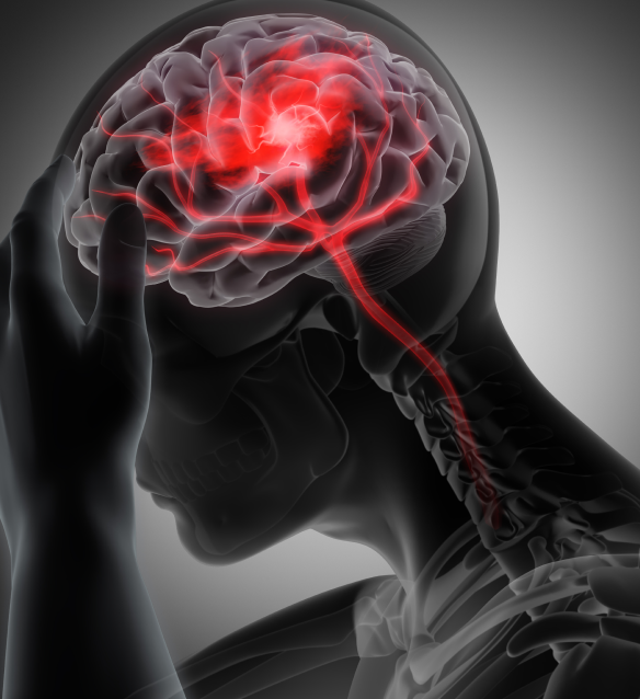 What are Psychosomatic Symptoms?
